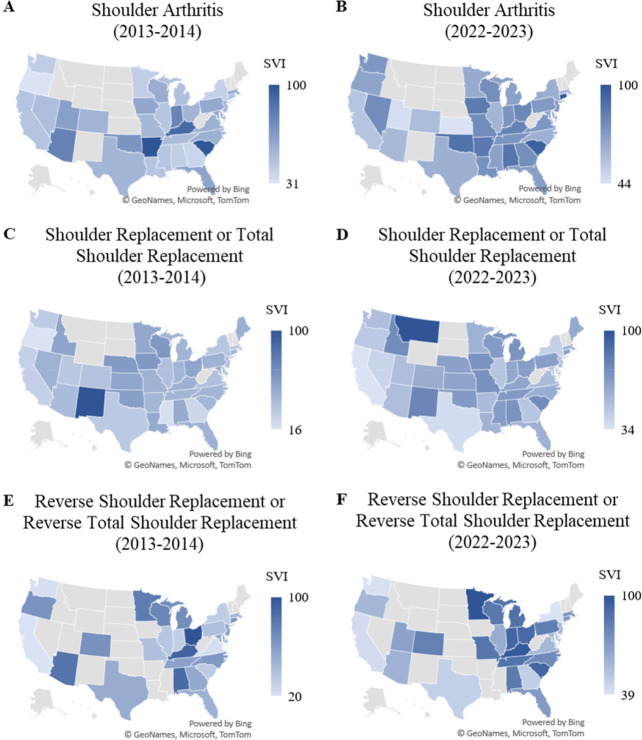 Consumer Interest in Shoulder Replacement Surgery: A Google Trends Analysis From 2013 to 2023.