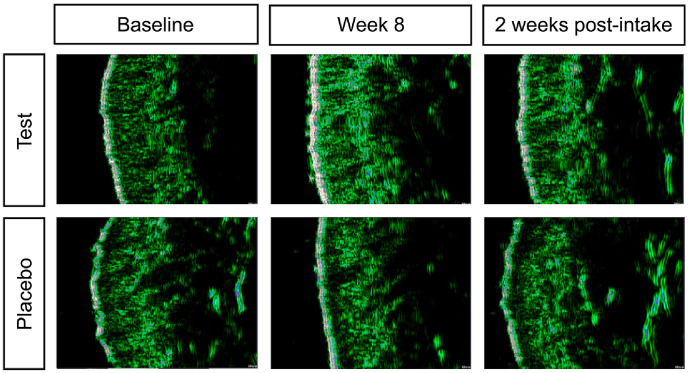 Skin Anti-Aging and Moisturizing Effects of Low-Molecular-Weight Collagen Peptide Supplementation in Healthy Adults: A Randomized, Double-Blind, Placebo-Controlled Clinical Trial.