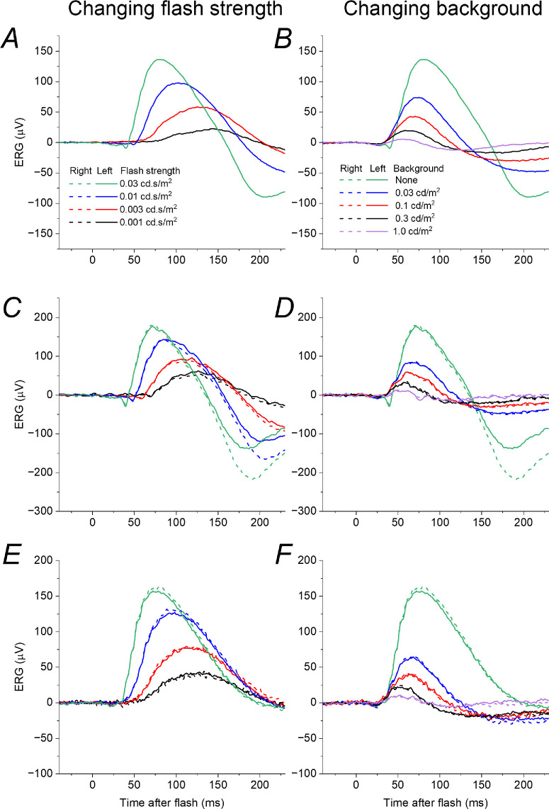 Selective Impairment of Rod-Driven Vision in Vitamin A Deficiency: Insights From Examining the Effect of Desensitizing Backgrounds.