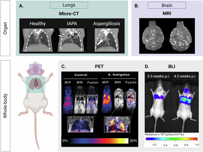 Fungal infections in focus: accelerating non-invasive imaging from preclinical insights to clinical breakthroughs.