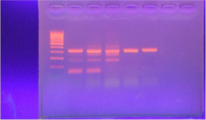 Association of WEE2 Gene Polymorphism with Fertilization Failure in Women Undergoing Intracytoplasmic Sperm Injection.