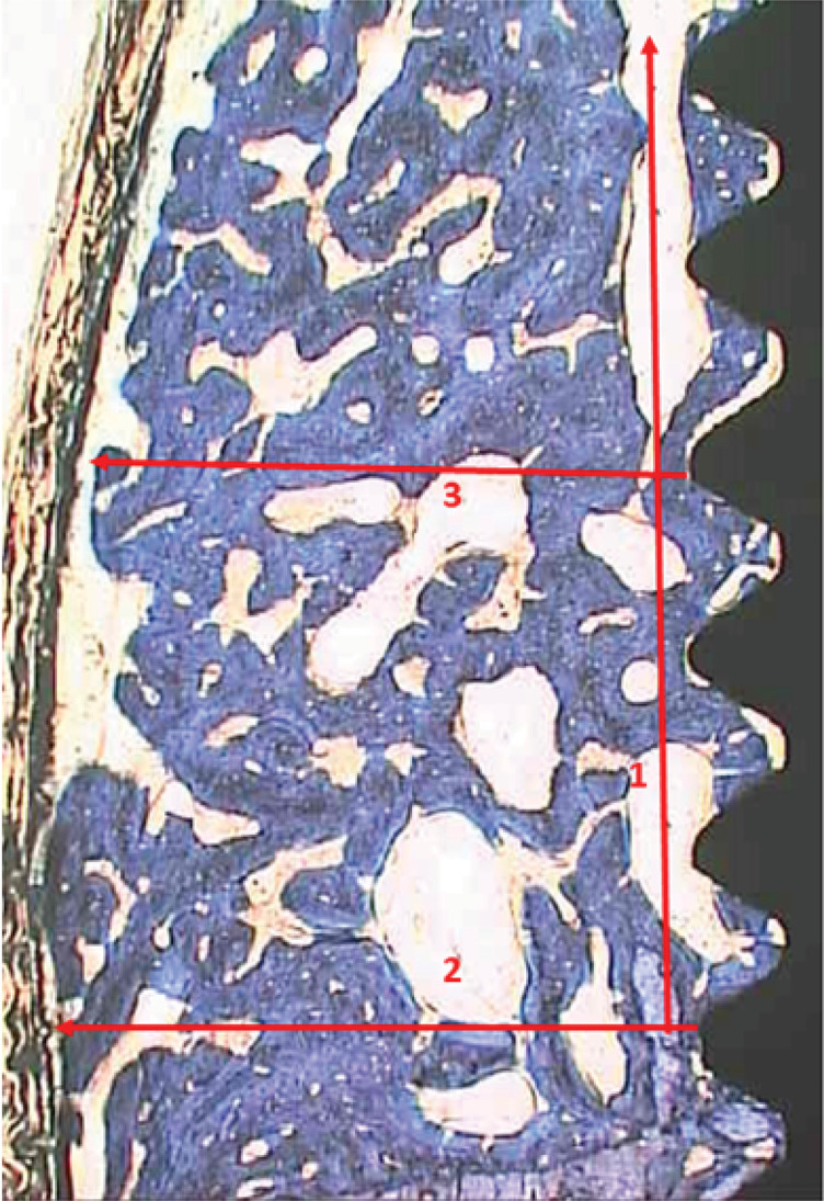 Influence of residual buccal bone thickness in dehiscence defects on osseointegrated dental implants in healed sites: an experimental in vivo study.