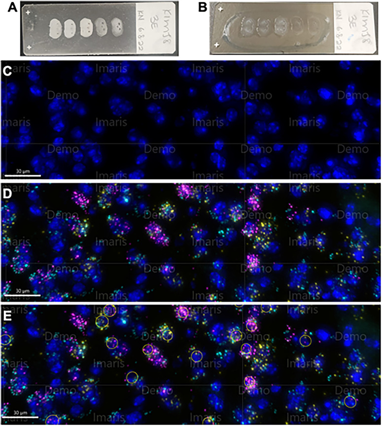 Neuronal Colocalization of μ-Opioid Receptor, κ-Opioid Receptor, and Oxytocin Receptor mRNA in the Central Nucleus of the Amygdala in Male and Female Mice.