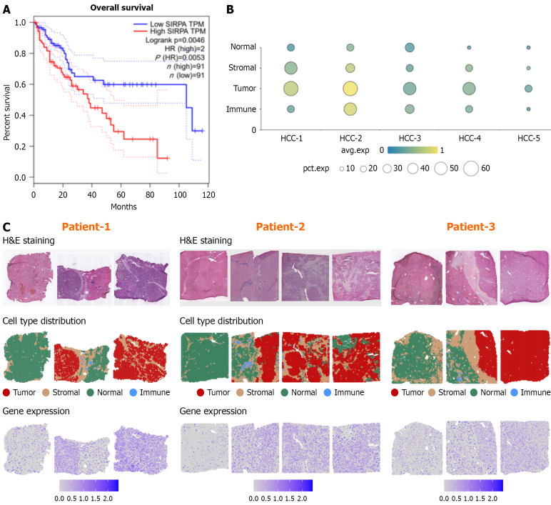 Immune checkpoint molecules signal regulatory protein alpha in the development of hepatocellular carcinoma.