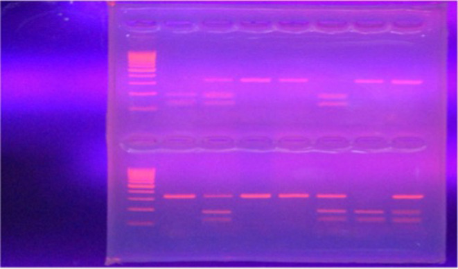 Association of WEE2 Gene Polymorphism with Fertilization Failure in Women Undergoing Intracytoplasmic Sperm Injection.
