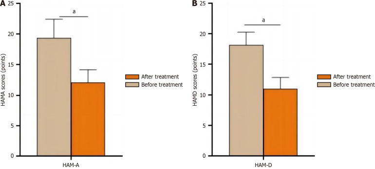 Impact of phakic intraocular lens implantation on anxiety and depression in patients with high myopia.