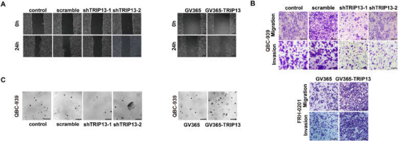 Correction: HMGA1-TRIP13 axis promotes stemness and epithelial mesenchymal transition of perihilar cholangiocarcinoma in a positive feedback loop dependent on c-Myc.