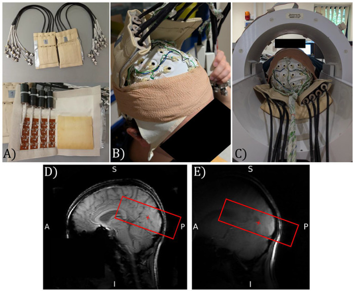 Cortical-layer EEG-fMRI at 7T: experimental setup and analysis pipeline to elucidate generating mechanisms of alpha oscillations.