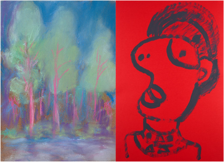 Integrating Art-Based Approaches in Psycho-Oncology Practice: Insights From a Pilot Creative Arts Workshop Designed for Cancer Patients Receiving Psychiatric Care.