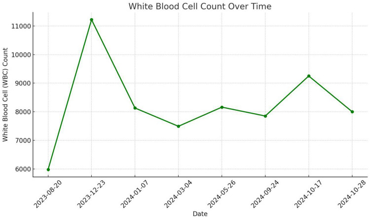 Eosinophilia Induced by Biosimilar Adalimumab (CinnoRA) in a Patient with Psoriasis and Psoriatic Arthritis: A Case Report.