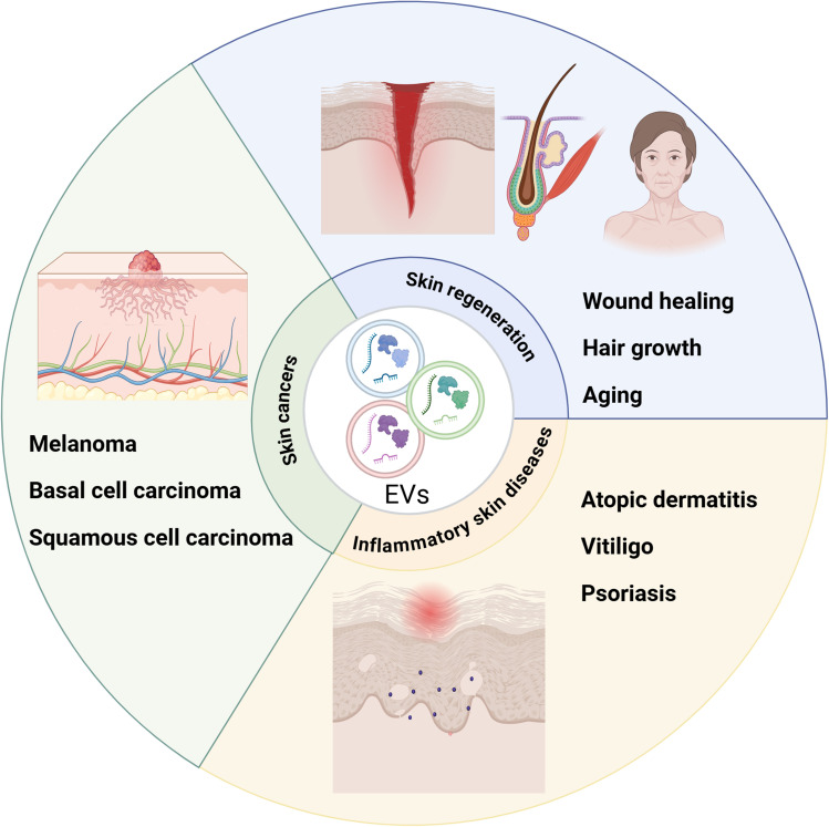 Extracellular Vesicles in Skin: Biological Function and Therapeutic Potential.