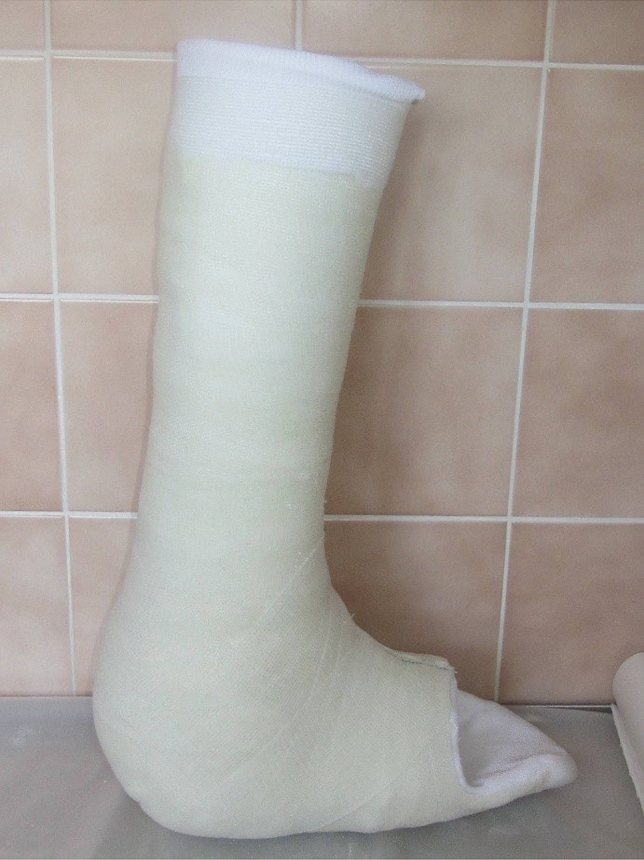 Charcot foot disease: A new approach.