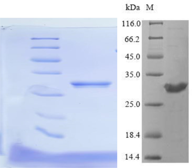 Biodegradation of patulin in apple juice by phosphoribosyl transferase (URA5): implications for food safety.