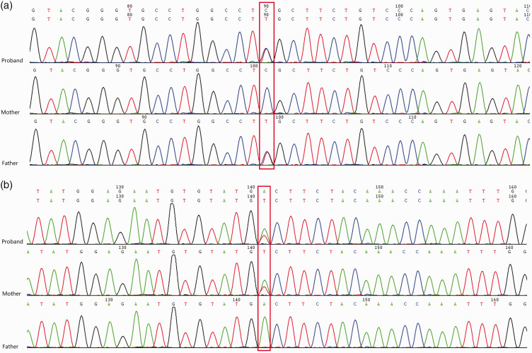 Mitochondrial 3-hydroxy-3-methylglutaryl-coenzyme A synthase 2 deficiency with severe hyperglycemia in a child: A rare case report.