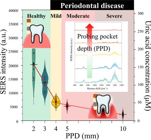Sensitive, Low-Cost, Early Detection of Periodontal Disease Using Surface-Enhanced Raman Spectroscopy with Easy-to-Use Silver Nanomesh-Coated Periopaper