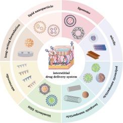 Interstitial drug delivery system: Physiological basis and (pre)clinical progress