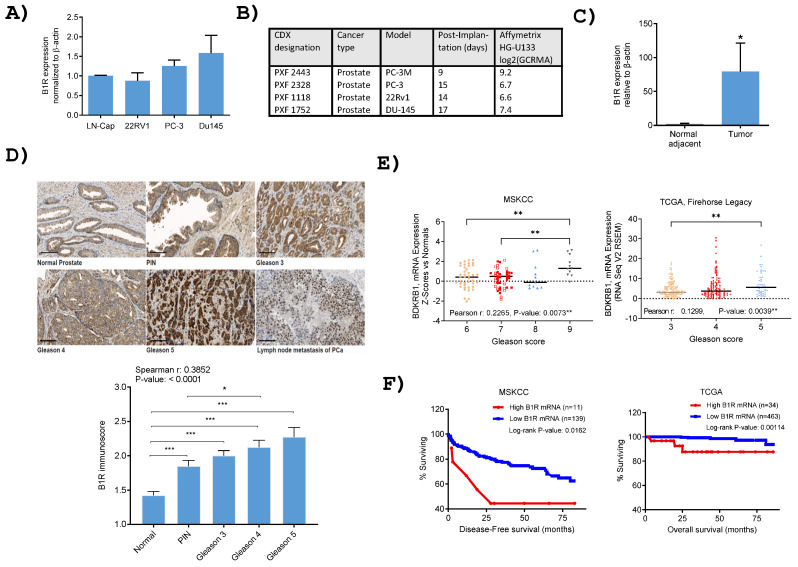 Theranostic Potential of a New <sup>64</sup>Cu-Labeled NOTA-R954 Peptide Conjugate for Kinin B1R Expressing Prostate Cancer.
