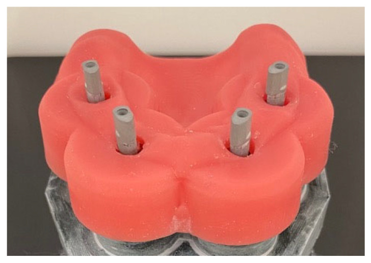 Fitting Accuracy and Constraint Force Measurement of Complete-Arch Implant-Supported Fixed Dental Prostheses Made from Cobalt-Chromium and Zirconia Frameworks Based on the All-on-Four Treatment Concept.