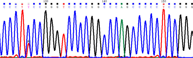 TERT promoter C250T mutation in a recurrent cervical chordoid meningioma: a unique case report.