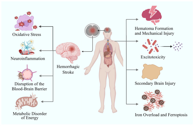 Multiple Applications of Nanomaterials in the Diagnosis and Treatment of Hemorrhagic Stroke.