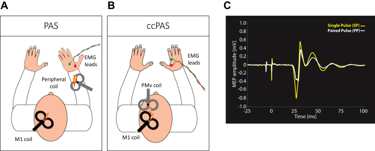 Promoting motor recovery after stroke using cortico-cortical paired associative stimulation.