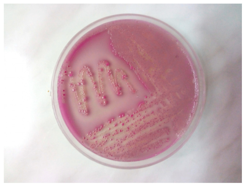 Multidrug-Resistant <i>Escherichia coli</i> Associated with Respiratory and Systemic Infection in a Domestic Rabbit in Romania: First Confirmed Case.
