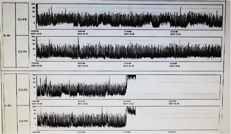 Prolonged resuscitation and systemic management of multi-organ dysfunction in a neonate with severe asphyxia: a case report.