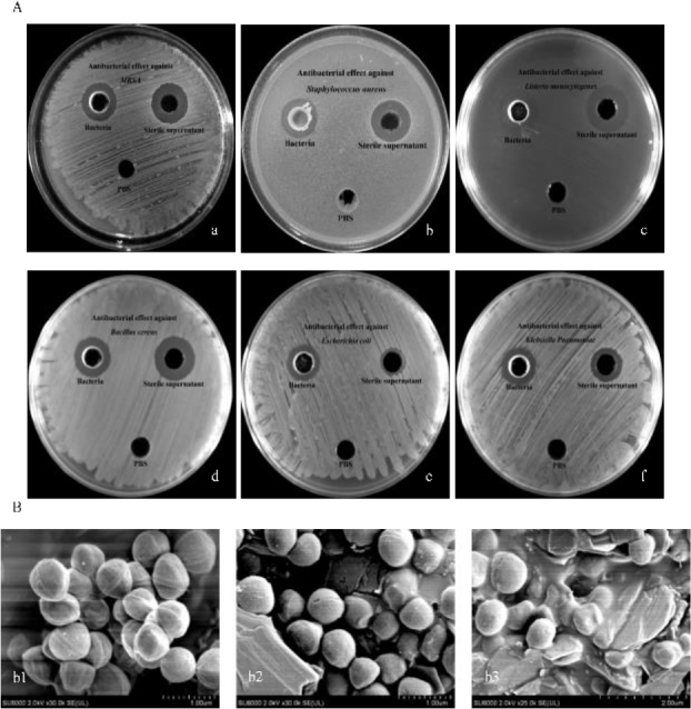 Antibacterial activity and genomic characterisation of a novel <i>Brevibacillus laterosporus</i> XJ-24-3 isolated from Xinjiang, China.