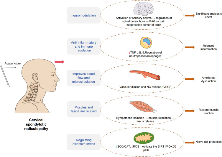 Application of Acupuncture in Cervical Spondylotic Radiculopathy: An In-Depth Analysis and Outlook on Pathophysiological Basis and Therapeutic Mechanisms.