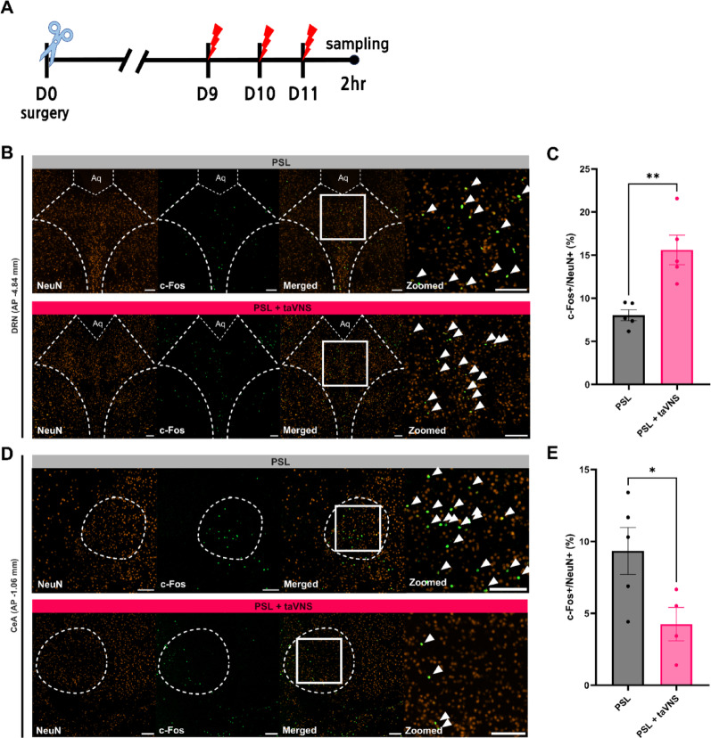 Analgesic effects of transcutaneous auricular vagus nerve stimulation on partial sciatic nerve ligation-induced neuropathic pain in mice via serotonergic pathways.