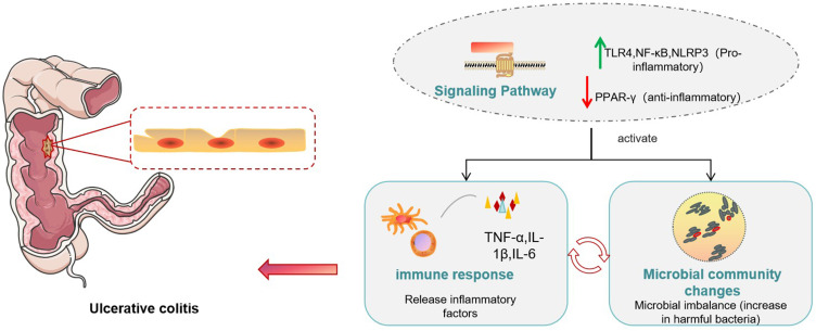 Mechanism of Morbidity Based on Ulcerative Colitis: A Review of Traditional Chinese Medicine Treatment of Ulcerative Colitis.