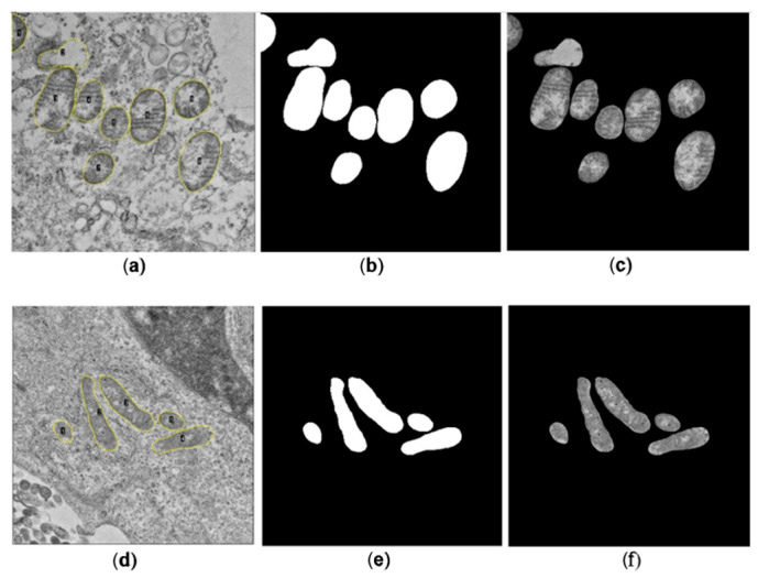 Deep Learning-Based Automatic Segmentation and Analysis of Mitochondrial Damage by Zika Virus and SARS-CoV-2.