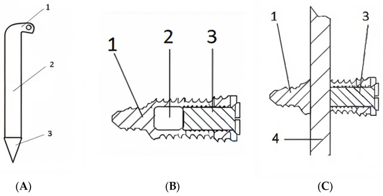 Original Locking Rod System Designed for Diaphyseal Fractures of Long Bones.