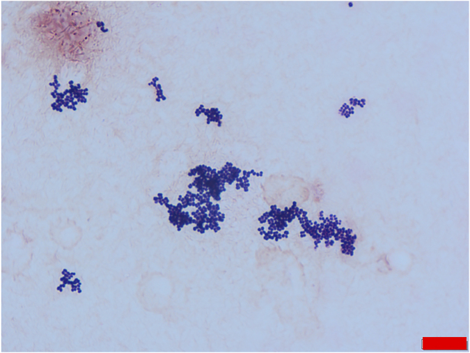 Relevance in question: A rare case of Actinomyces radicidentis bacteremia.