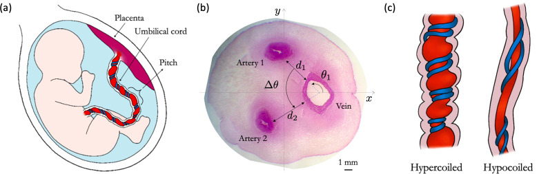 A functional shunt in the umbilical cord: the role of coiling in solute and heat transfer.