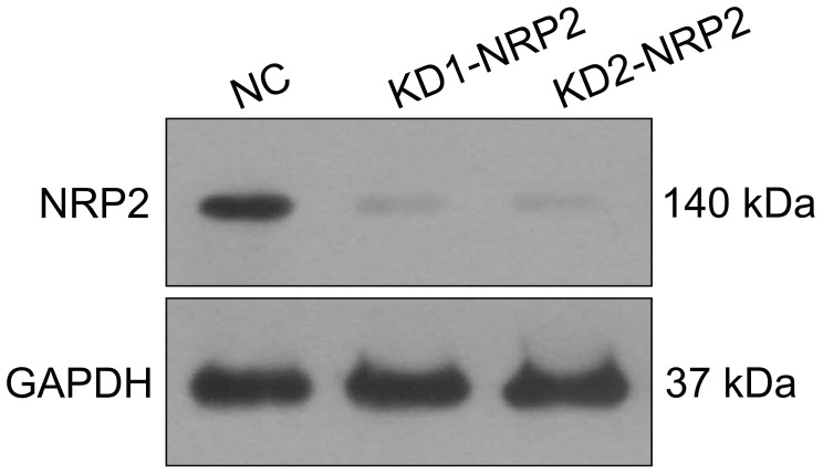 Neuropilin-2 Mediates Radioresistance in Nasopharyngeal Carcinoma via Wnt/β-Catenin Pathway.