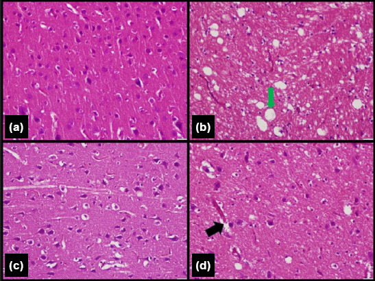 Does infliximab attenuate oxidative stress following traumatic brain injury?