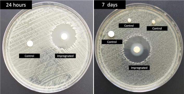 VANCOMYCIN- AND CHLORHEXIDINE DIGLUCONATE-IMPREGNATED DRESSING FOR THE PREVENTION OF ORTHOPEDIC SURGICAL SITE INFECTIONS: A PILOT STUDY USING A LOW-COST PROCEDURE.