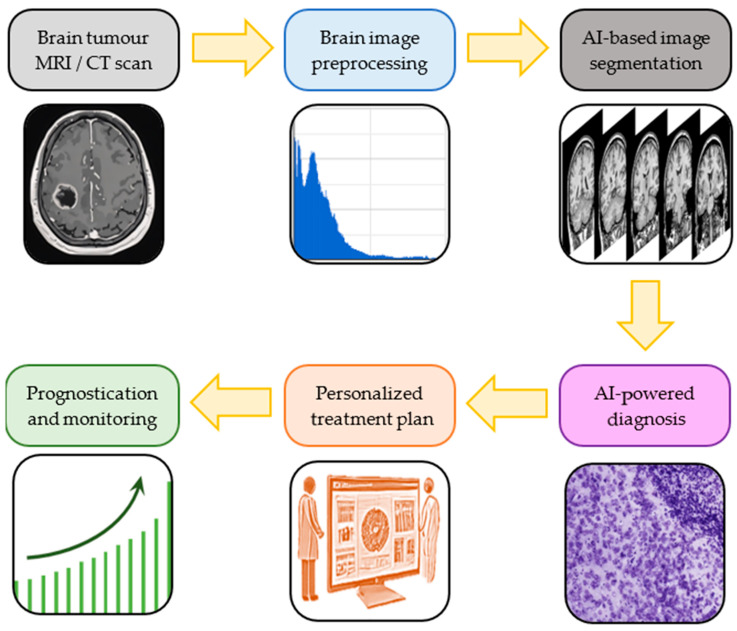 Artificial Intelligence in the Diagnosis and Treatment of Brain Gliomas.
