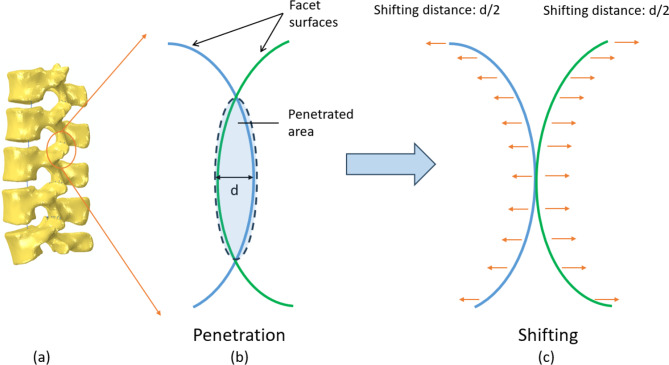 A pipeline to morph finite element models of the lumbar spine for generation of customised spinal cages.