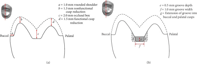 Effect of a Modified Preparation Design on the Marginal and Internal Fit of 3D-Printed Onlays: A Feasibility Study.