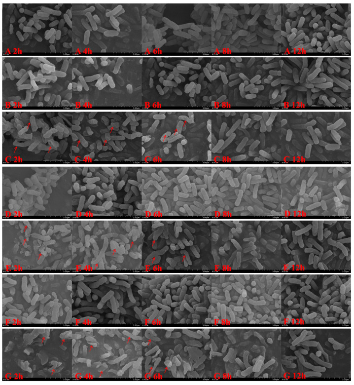 Postβ-Lactamase-Inhibiting Effect of Sulbactam in Combination with Ceftriaxone on Extended-Spectrum-β-Lactamase-Producing <i>Escherichia coli</i>.