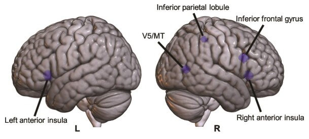 Anterior insular activity signals perceptual conflicts induced by temporal and spatial context.