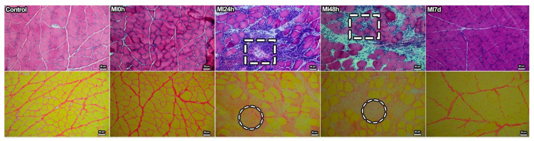 Structural Proteins at Neuromuscular Junction Are Downgraded While NRG1 and Agrin Gene Expression Increases After Muscle Injury.