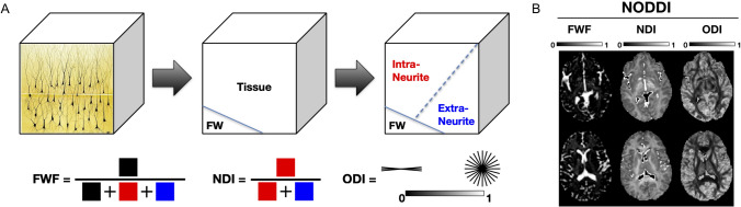 In vivo mapping of infant brain microstructure with neurite orientation dispersion and density imaging.