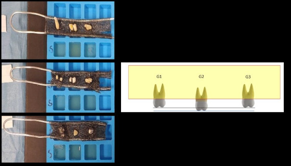 A Pilot Study on the Deposition of Drugs in Dental Tissues as Alternative Matrices for Forensic Toxicology.