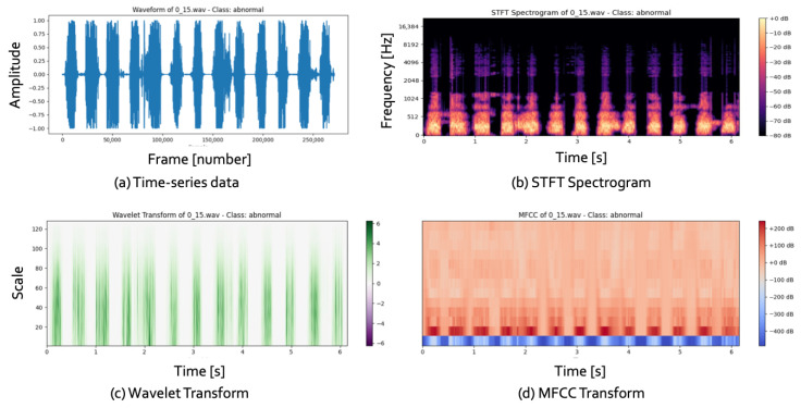 Deep Learning for Heart Sound Abnormality of Infants: Proof-of-Concept Study of 1D and 2D Representations.