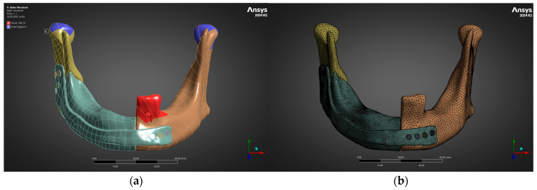 Data-Driven Design and Additive Manufacturing of Patient-Specific Lattice Titanium Scaffolds for Mandibular Bone Reconstruction.