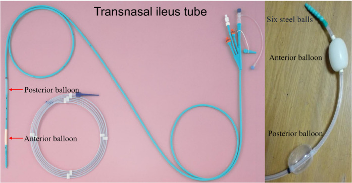 A novel approach of manual manipulation of the transnasal ileus tube for severe or recurrent benign adhesive small bowel obstruction.