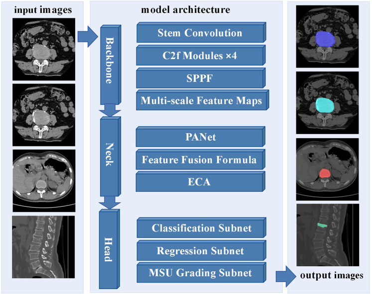 Intervertebral disc anomaly intelligent classification system based on deep learning, IDAICS.